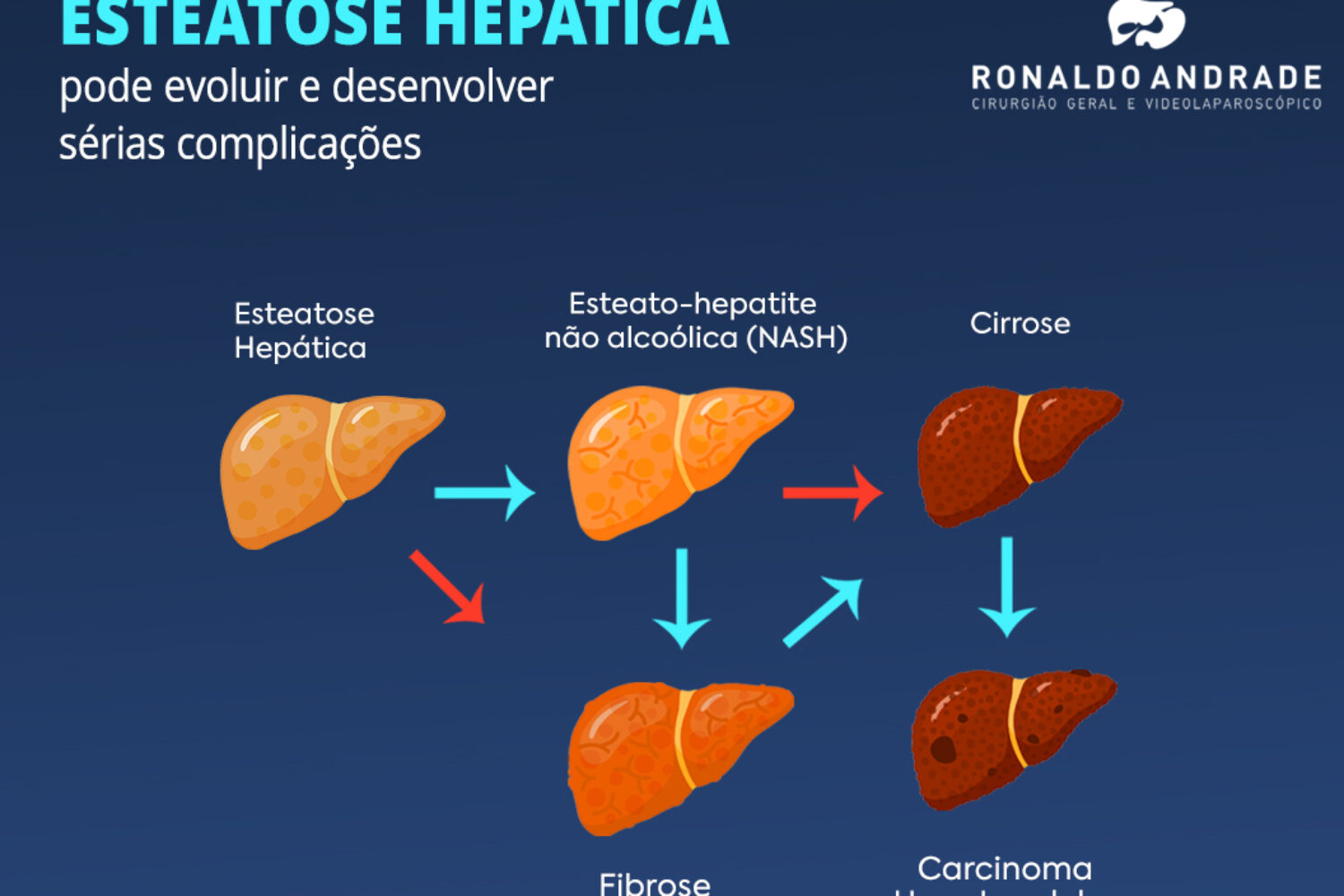 Esteatose Hepática Dr. Ronaldo Andrade Esteatose Hepática Dr. Ronaldo Andrade